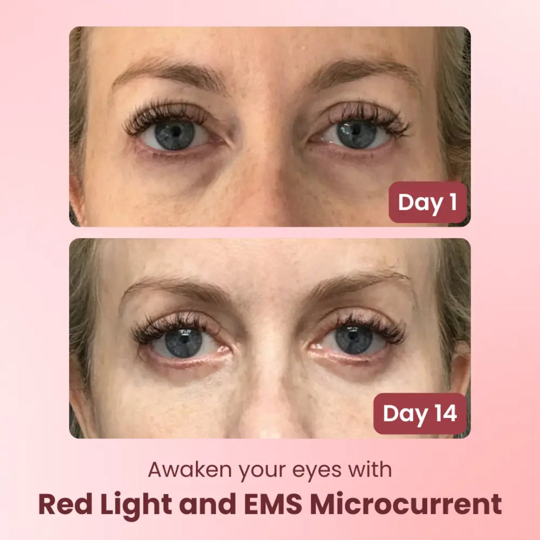 🚀Valors Red Light Eye Massager