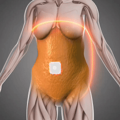 Patch Trick™ Weight Loss Patch – Burn Fat While You Sleep, No Diet or Exercise Needed 🌙🔥