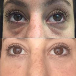 🔥 FINAL CLEARANCE: 50% OFF THE LUMI EYE RENEWAL — JUST $39.99! 🔥