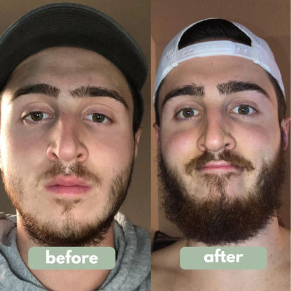 Valors- Beard Growth Serum