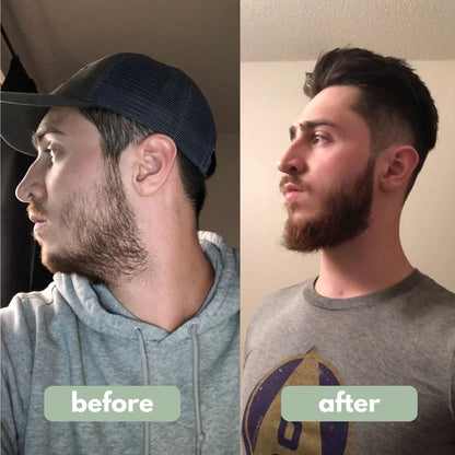 Valors- Beard Growth Serum