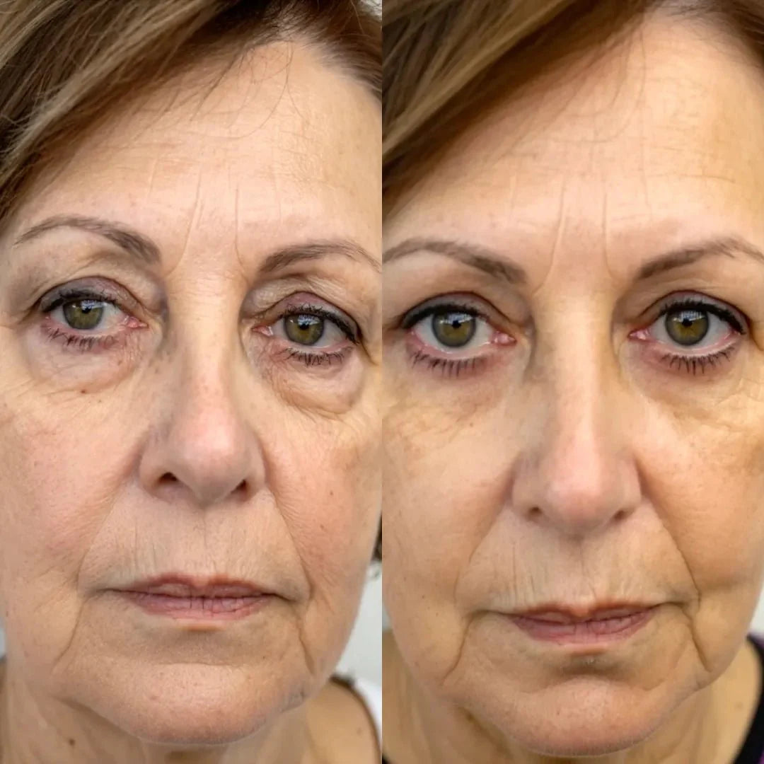 💖 Mother’s Day 70% OFF – RevitalEyes® 2-in-1 Red Light + EMS Eye Bag Remover