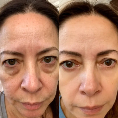 💖 Mother’s Day 70% OFF – RevitalEyes® 2-in-1 Red Light + EMS Eye Bag Remover