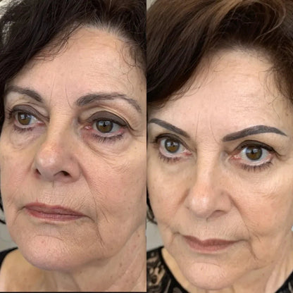💖 Mother’s Day 70% OFF – RevitalEyes® 2-in-1 Red Light + EMS Eye Bag Remover
