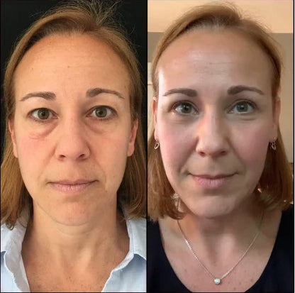 🔥 FINAL CLEARANCE: 50% OFF THE LUMI EYE RENEWAL — JUST $39.99! 🔥