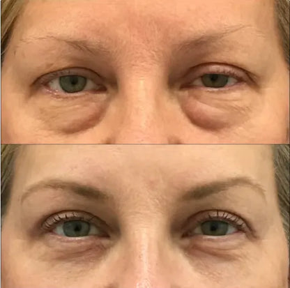 🔥 FINAL CLEARANCE: 50% OFF THE LUMI EYE RENEWAL — JUST $39.99! 🔥