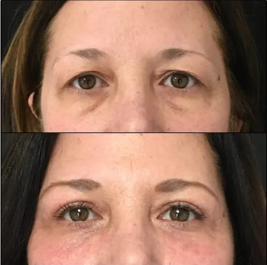 🔥 FINAL CLEARANCE: 50% OFF THE LUMI EYE RENEWAL — JUST $39.99! 🔥