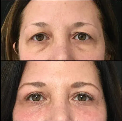 🔥 FINAL CLEARANCE: 50% OFF THE LUMI EYE RENEWAL — JUST $39.99! 🔥