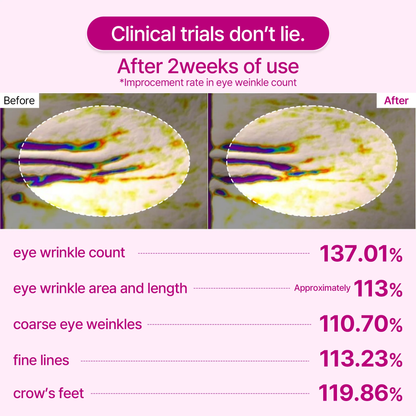 🔥LAST DAY SALE 40% OFF-🔥Cemenrete Calcium Duo