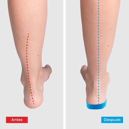 ComfyFeet Insoles - Enjoy pain-free days